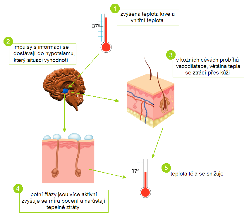 Schéma hypertermie